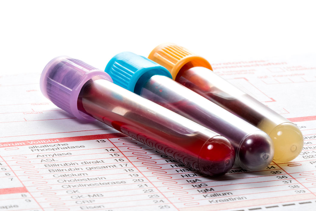 Home blood sample collection, free blood sampling, blood sample collection in lahore